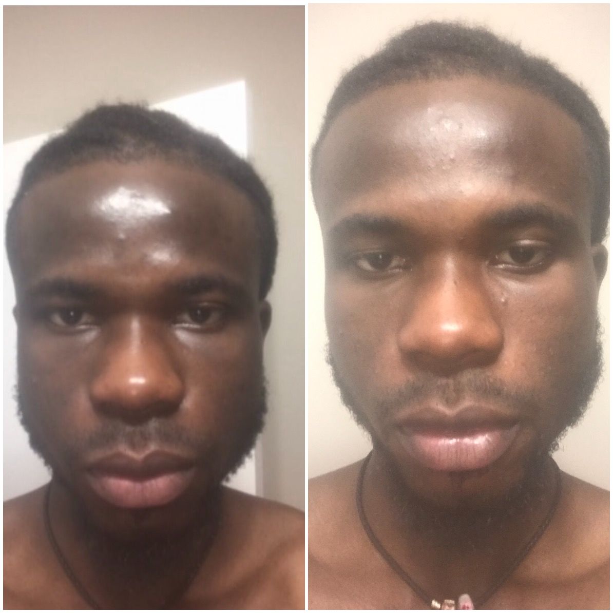 Customer photo review of Omic LightenUp PLUS Lightening Body Lotion - 400ml