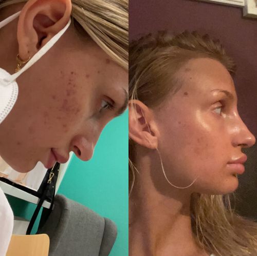 Customer photo review of Sleek Skin Serum 30ml