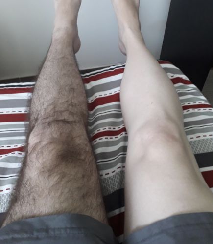 Customer photo review of Depilador Nuva Skin®