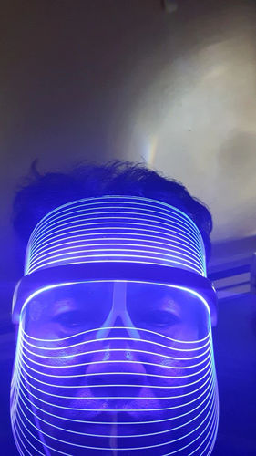 Customer photo review of HexoMask™ - LED Light Therapy Face Mask