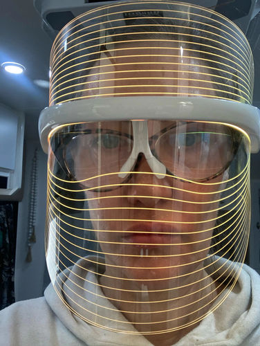 Customer photo review of HexoMask™ - LED Light Therapy Face Mask