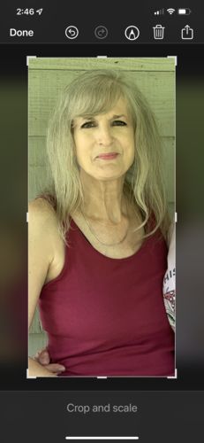 Customer photo review of Radiation Relief Cream – Unscented Burn Cream for Radiation Therapy