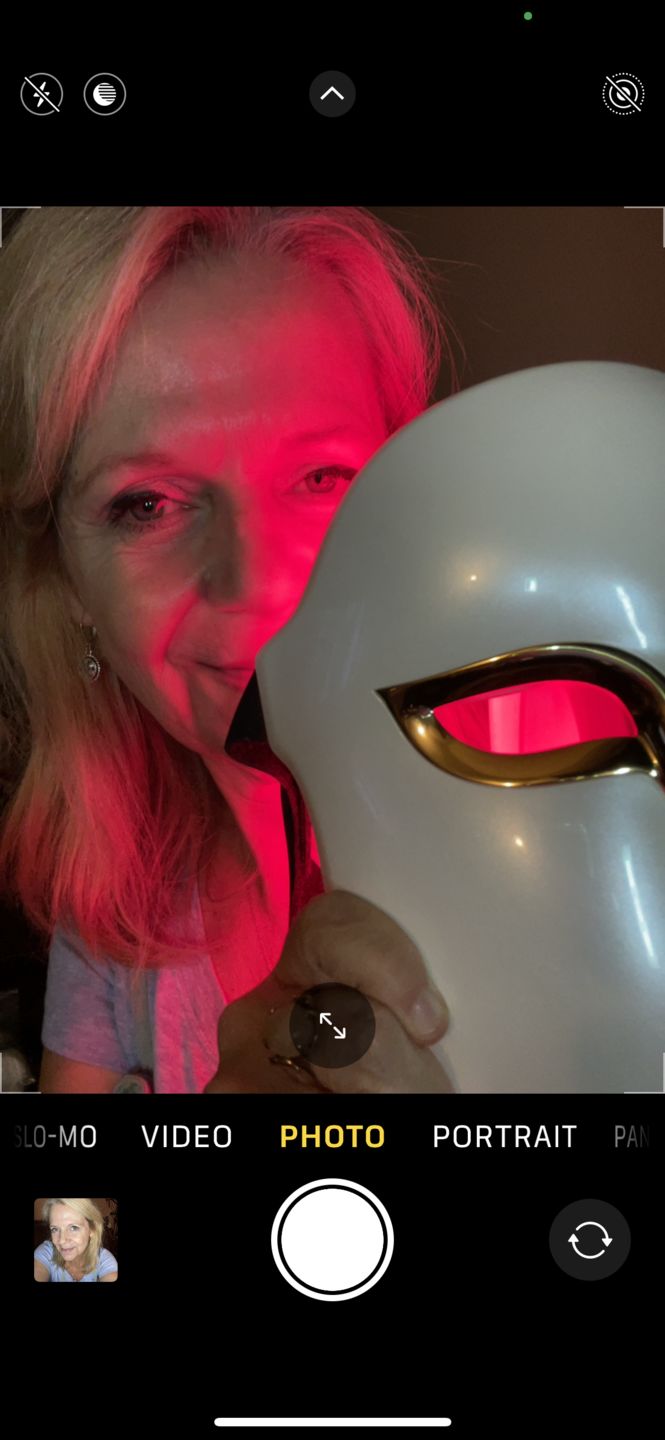 Customer photo review of EvenSkyn® Mirage: Pro LED Phototherapy Face Mask