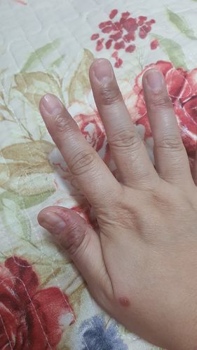 Customer photo review of Jolicare Cream