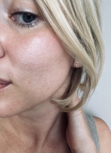 Customer photo review of Niacid