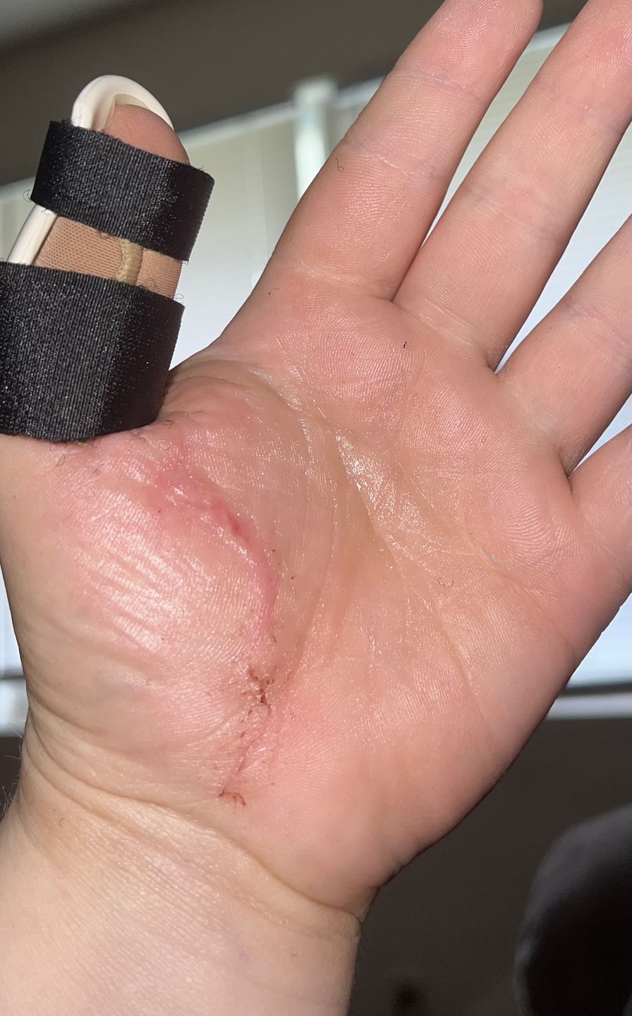 Customer photo review of Combat Ready Ointment - Mother of All Bottles (MOAB)