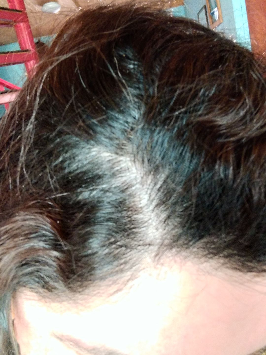 Customer photo review of SHAMPOO ANTICASPA GRASA FORMATO BARRA