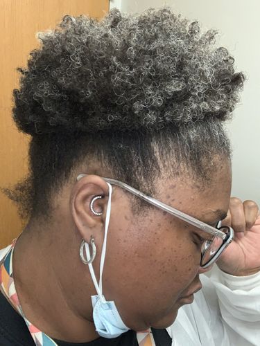 Customer photo review of Rice Water Scalp Mist (PreMade)