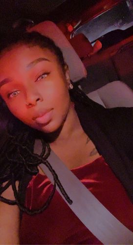 Customer photo review of Citha Hazel Contact Lenses(12 months wear)