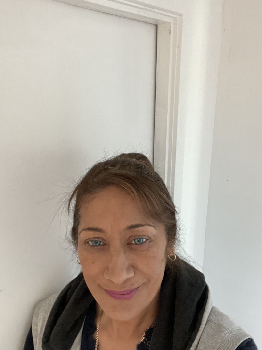 Customer photo review of Himalaya Blue Prescription Colored Contact Lenses