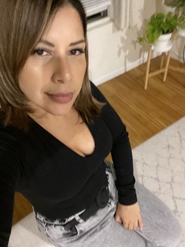 Customer photo review of JawlineFix: Filler