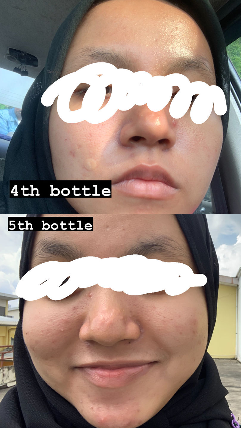 Customer photo review of Face Set