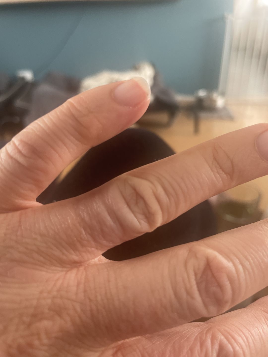 Customer photo review of Eczema Saviour