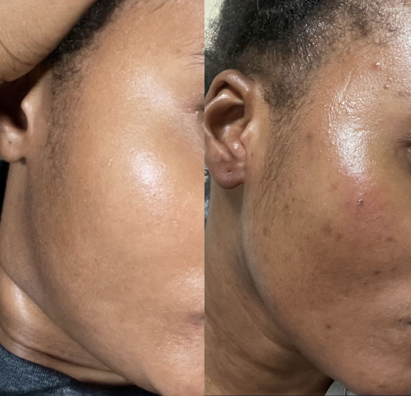 Customer photo review of Gmaeum Clear Complexion Set