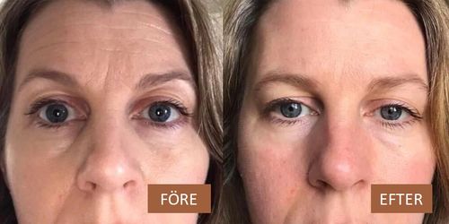Customer photo review of YoungerMe™ Anti-Aging Collagen Serum