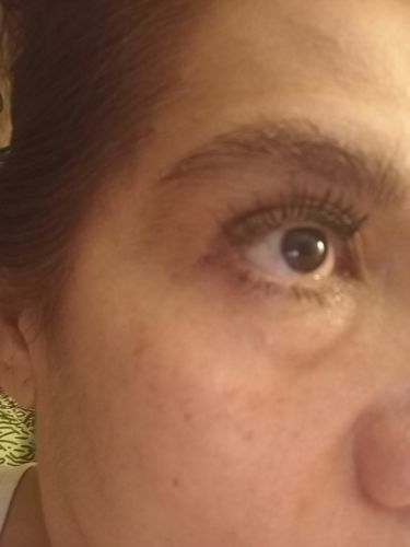 Customer photo review of Serum Retinol
