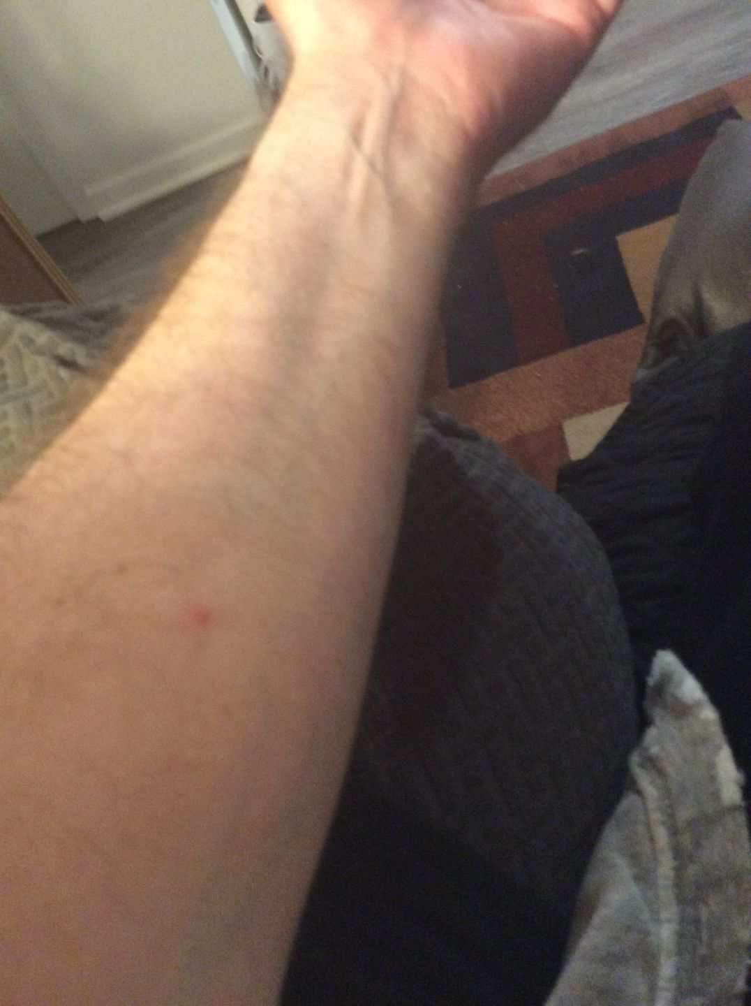 Customer photo review of Combat Ready Ointment - Mother of All Bottles (MOAB)