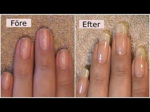 Customer photo review of NailGrowth™ Nourishing Oil Pen