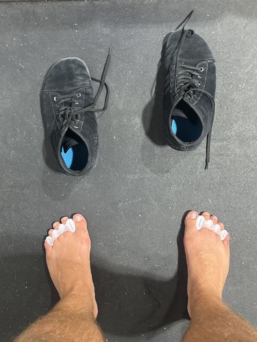 Customer photo review of Correct Toes®