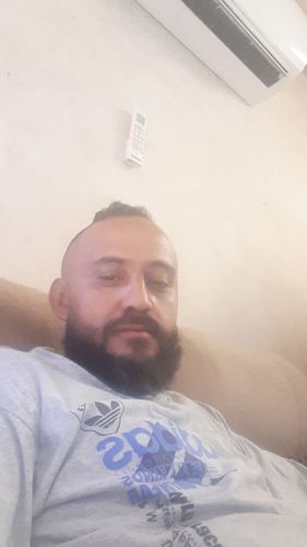 Customer photo review of Kit de Crecimiento de Barba y Bigote Bálsamo Minoxidil 18% + 1 Aceite Premium