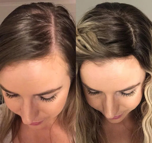 Customer photo review of MagneticTherapy™ Hair Growth Tool