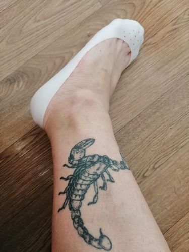 Customer photo review of ComfyFeet™ Anti-Cracking Foot Socks