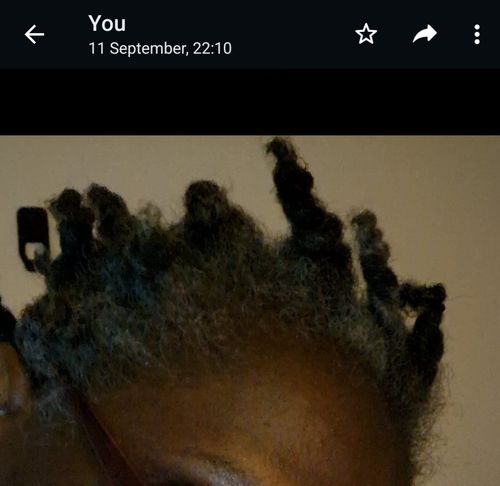 Customer photo review of Hair Growth Potion - Extra Strength