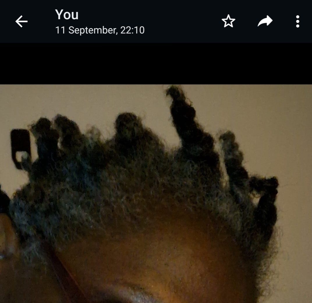 Customer photo review of Hair Growth Potion - Extra Strength
