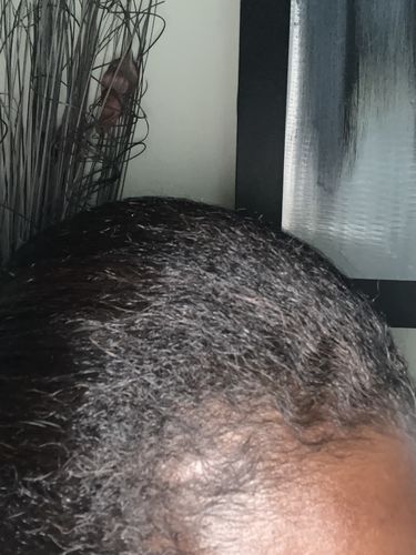 Customer photo review of Hair Growth Duo
