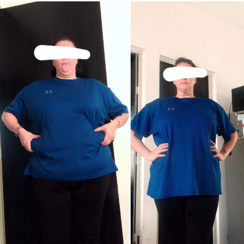 Customer photo review of Mesofrance Cóctel Súper Reductivo Intenso 10 Ámpulas/5ml