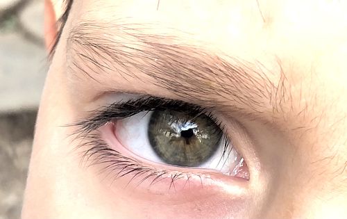 Customer photo review of Neala Green Contact Lenses(12 months wear)