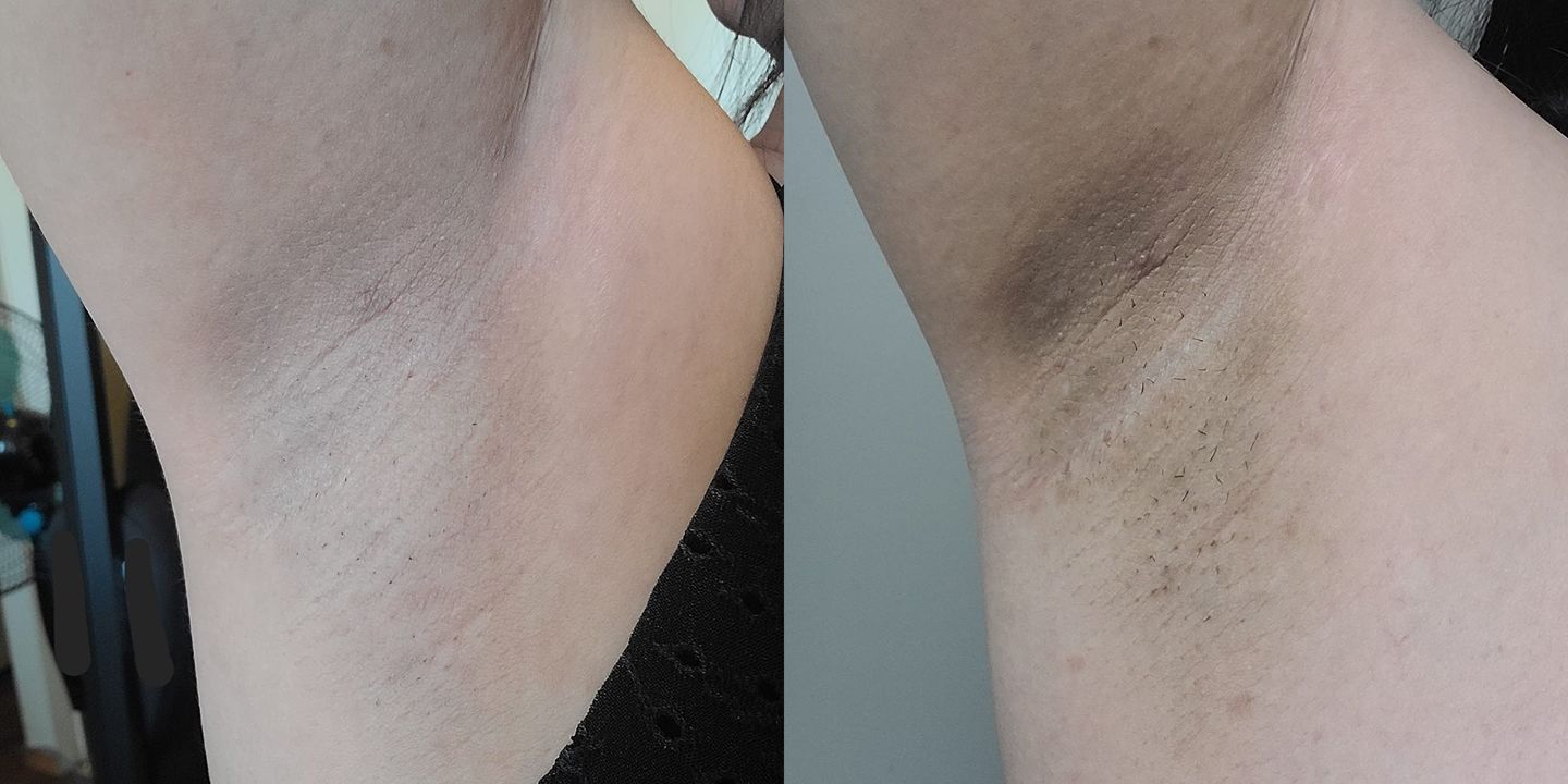 Customer photo review of Intimate Lightening Cream