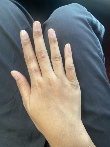 Customer photo review of Jolicare Cream