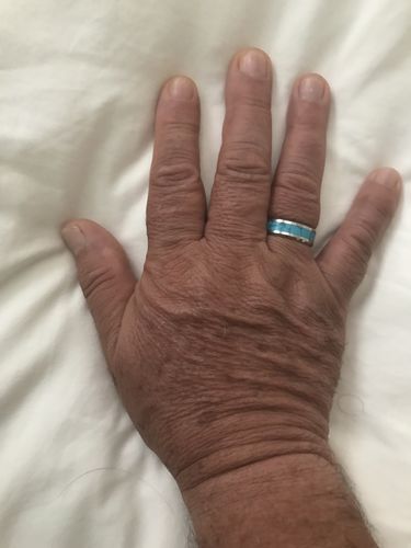 Customer photo review of 8mm Blue Turquoise Inlaid Stainless Beveled Edge Wedding Ring