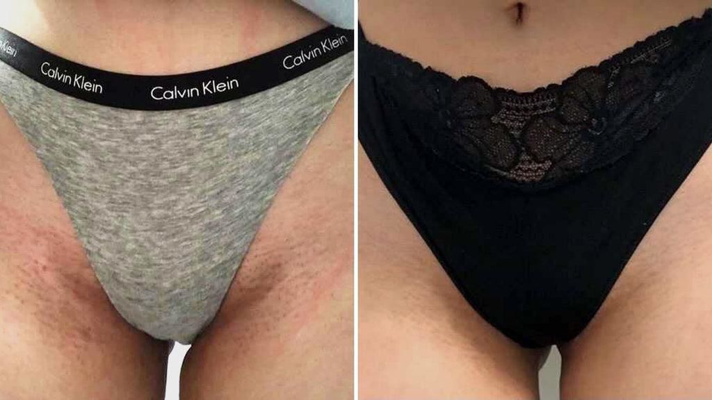 Customer photo review of Intimate Lightening Cream