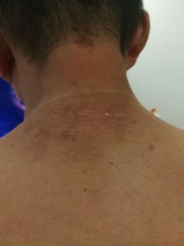 Customer photo review of Jolicare Cream