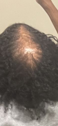Customer photo review of CAFFEINE HAIR GROWTH SHAMPOO