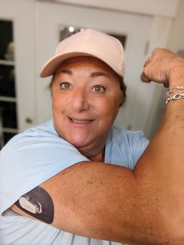 Customer photo review of Skin Grip MAX Dexcom G6 Patches