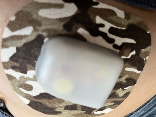 Customer photo review of Skin Grip Omnipod Adhesive Patches