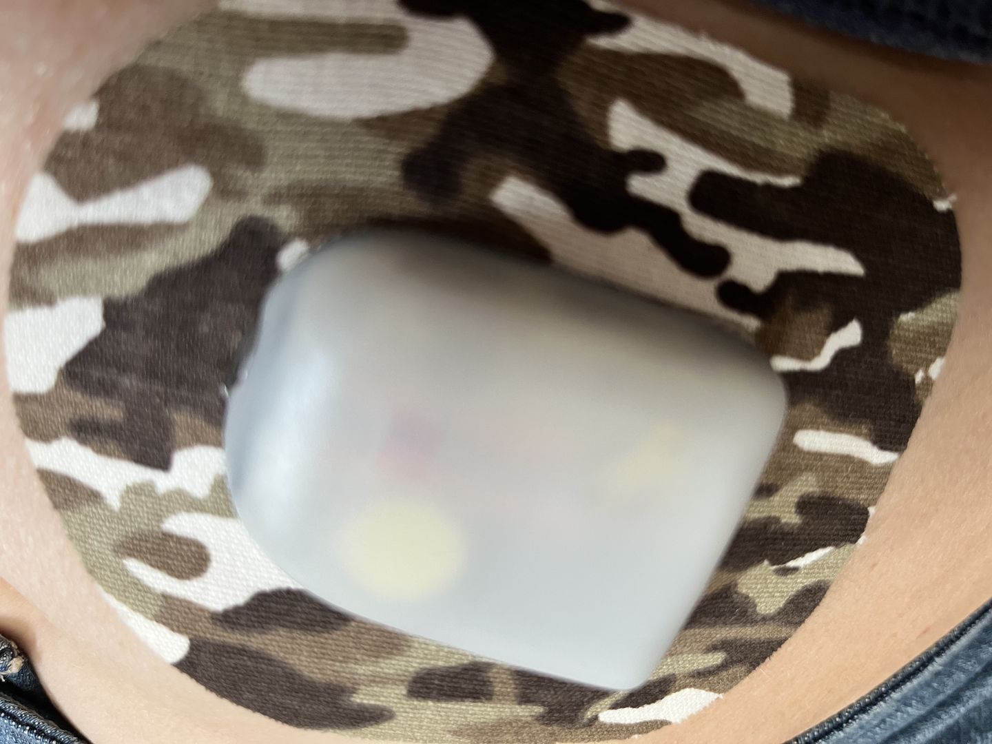 Customer photo review of Skin Grip Omnipod Adhesive Patches