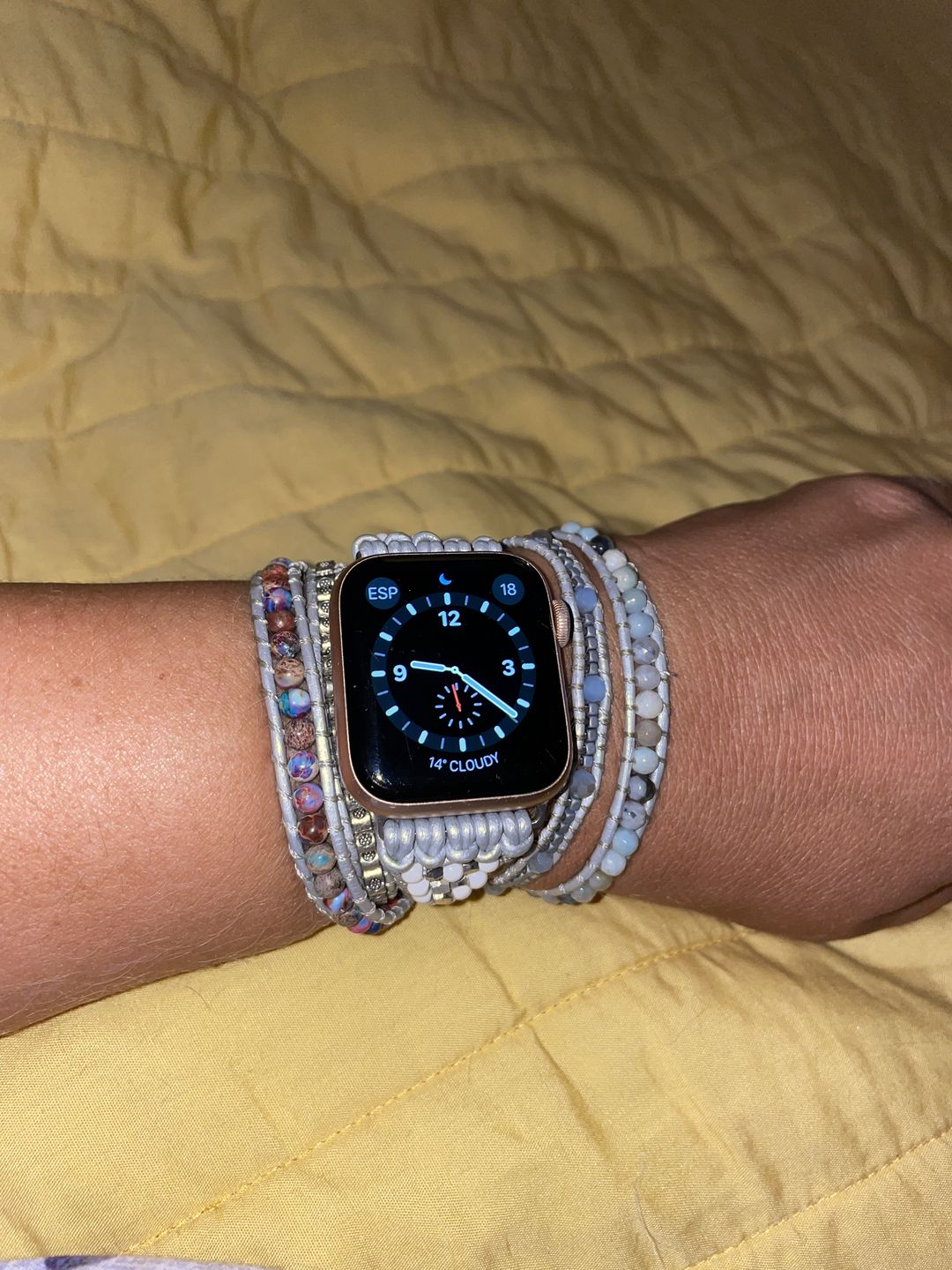 Customer photo review of Healing Turquoise Protection Apple Watch Strap