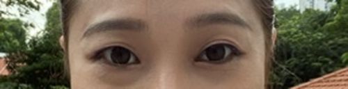 Customer photo review of Add Choco (2pcs) (Buy 1 Get 1 Free) 1Month G.DIA 13.6mm