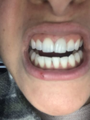 Customer photo review of 2597 C Color Corrector Serum