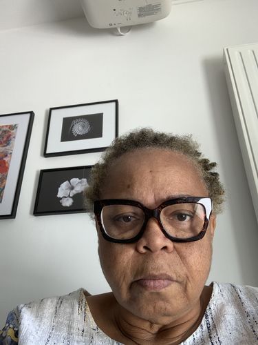 Customer photo review of Gummies pousse cheveux 6 mois