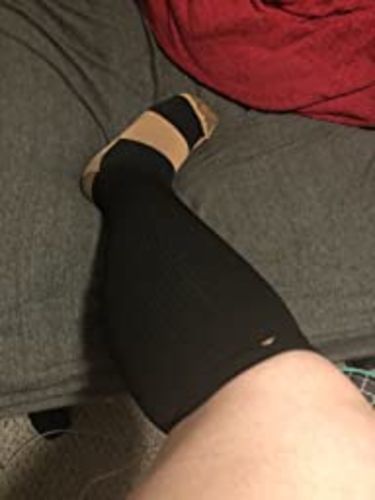 Customer photo review of Antifungal copper compression socks with moisture-wicking antimicrobial fibers