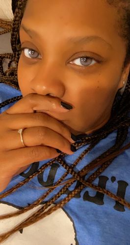 Customer photo review of SL29 Blue Contact Lenses(12 months wear)