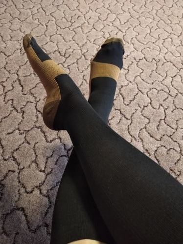 Customer photo review of Antifungal copper compression socks with moisture-wicking antimicrobial fibers