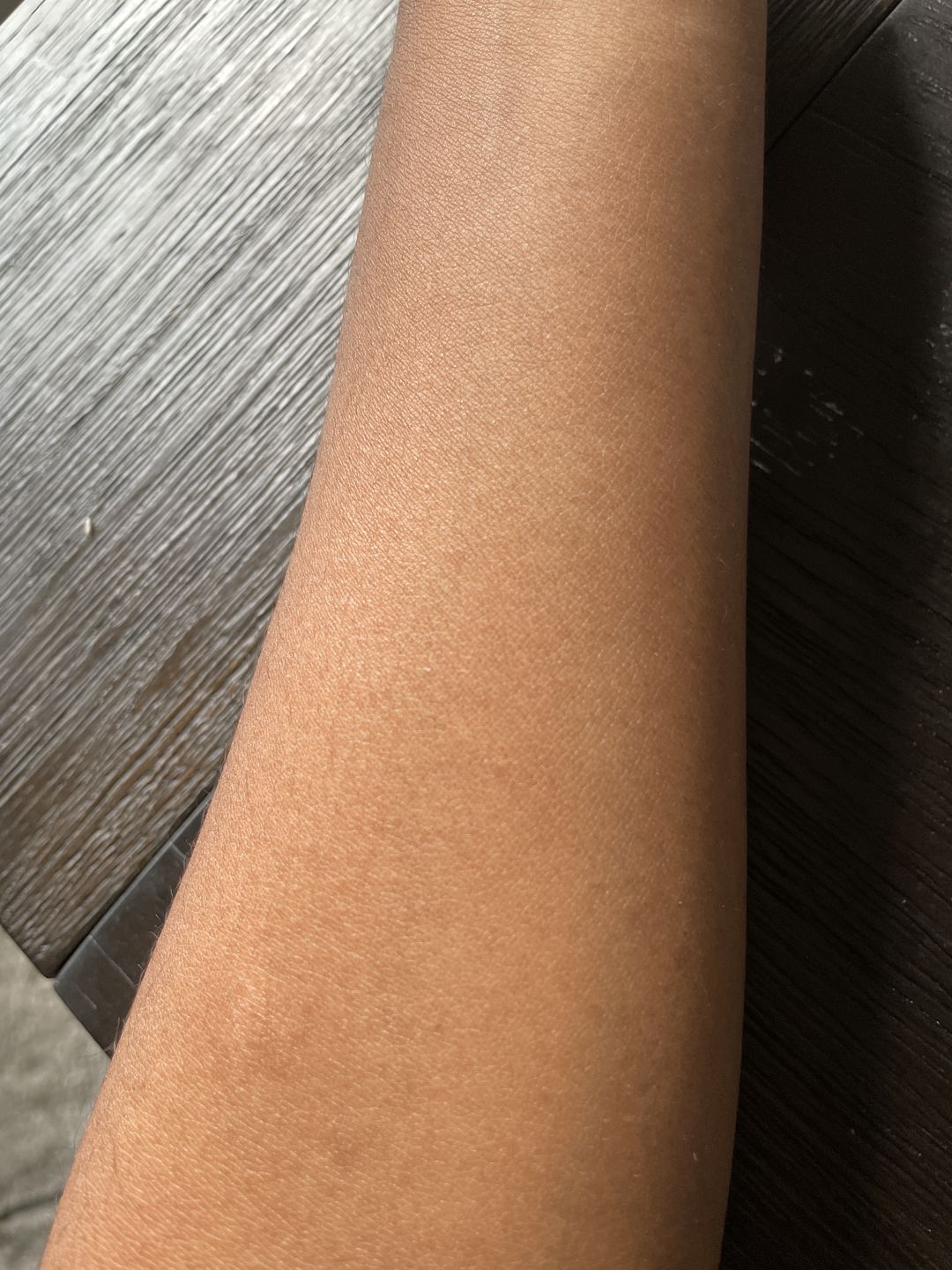 Customer photo review of Fair and White Glutathion Extra Serum Anti-Dark Spot 30ml / 1.01 Fl Oz