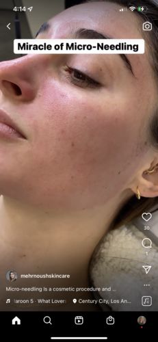 Customer photo review of Scalpa Plant Cell Serum With FREE Training