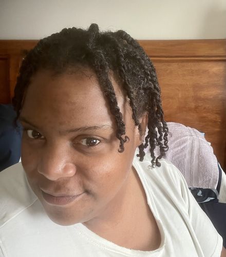 Customer photo review of Fro Butter with Peppermint Oil | For Dry Scalp & Dandruff